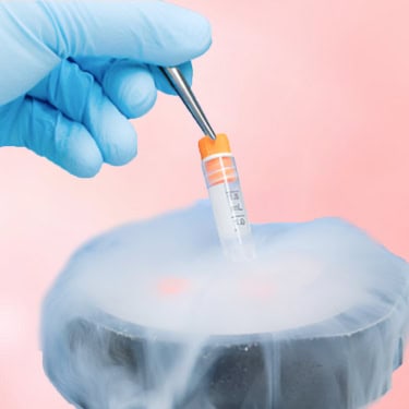 IUI –Intrauterine Insemination or Artificial Insemination (AI)